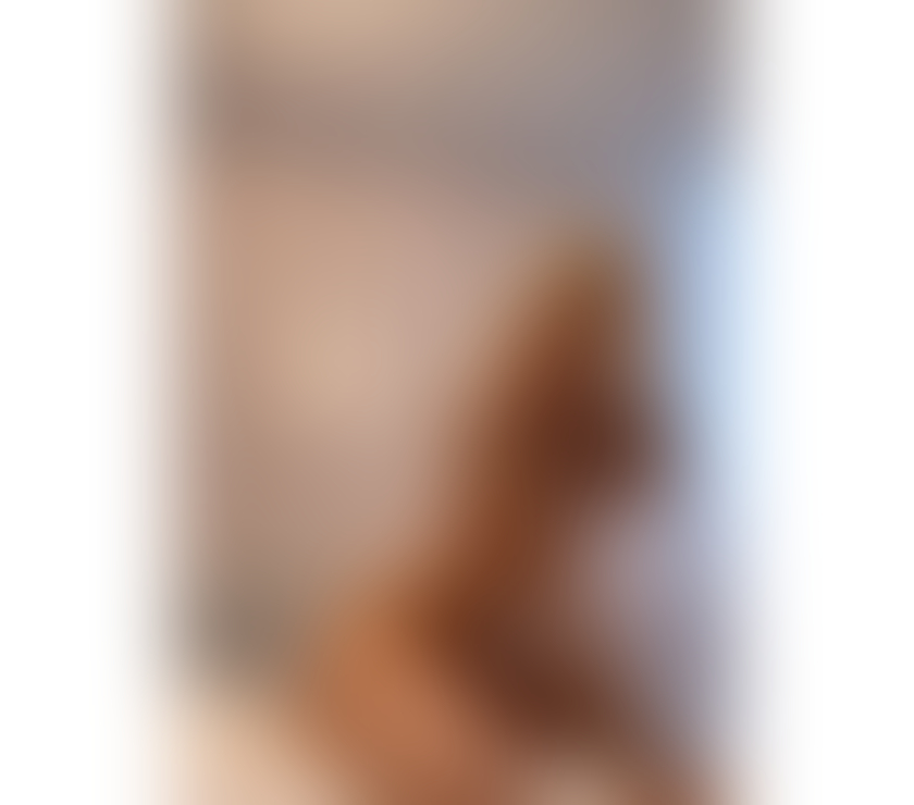 Escorts East London Forest Gate - East London - Photos for MEDEEA🔥 Perfect Body💖BEST GFE 🥂PARTYGIRL